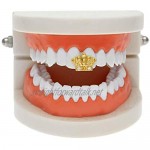 Crown Molding Diamond Gold Single Braces Hip Hop Teeth